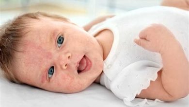 Bebeklerde Alerjik Reaksiyon Belirtileri ve Tedavisi